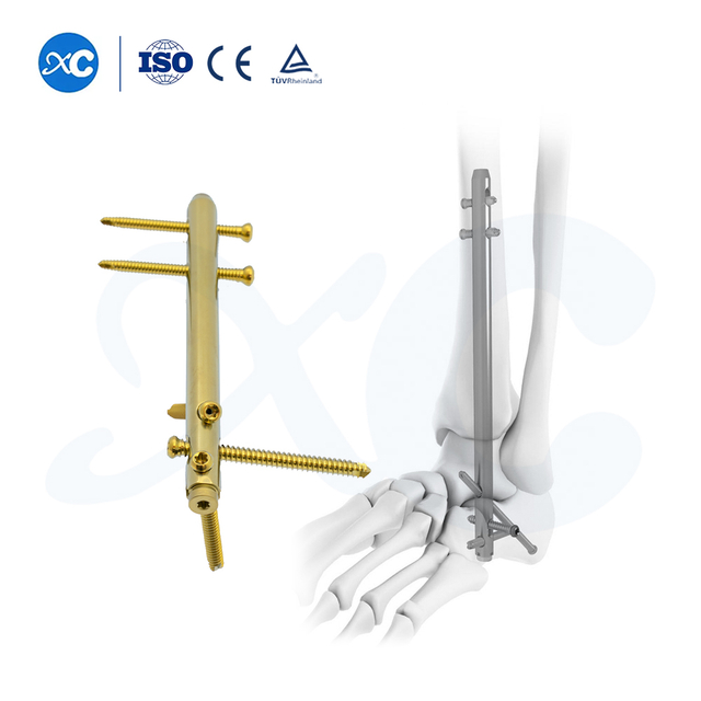 Clavo de tobillo para fusi&oacute;n del retropi&eacute; - Compre producto en XC Medico