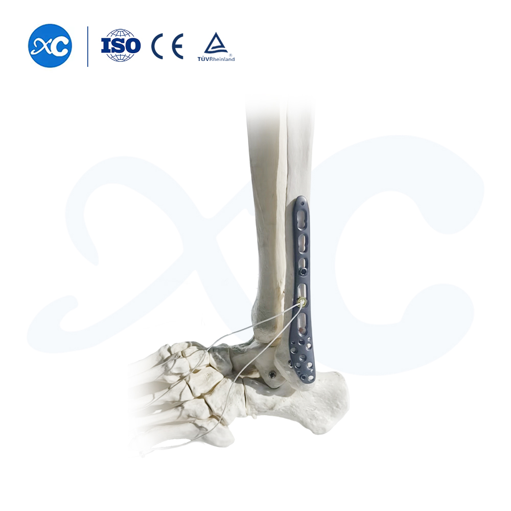 Plat Pengunci Tibiofibuler Distal-III - Beli Produk di XC Medico