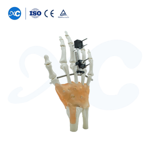 Sab nrauv Fixation rau Metacarpals Thiab Phalanges - Yuav Khoom ntawm XC Medico