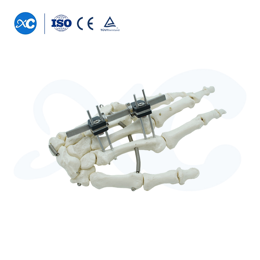 Mini Fixator Jenis Lurus