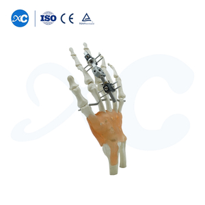 Mini Fixator Joint Motion Hom