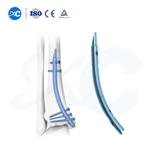 U&ntilde;a Tibial Distal ukaxa | Sistema de Fijaci&oacute;n Intramedular Retr&oacute;grada ukaxa | XC Medico Ortopedia ukax m&auml; juk’a pachanakanwa