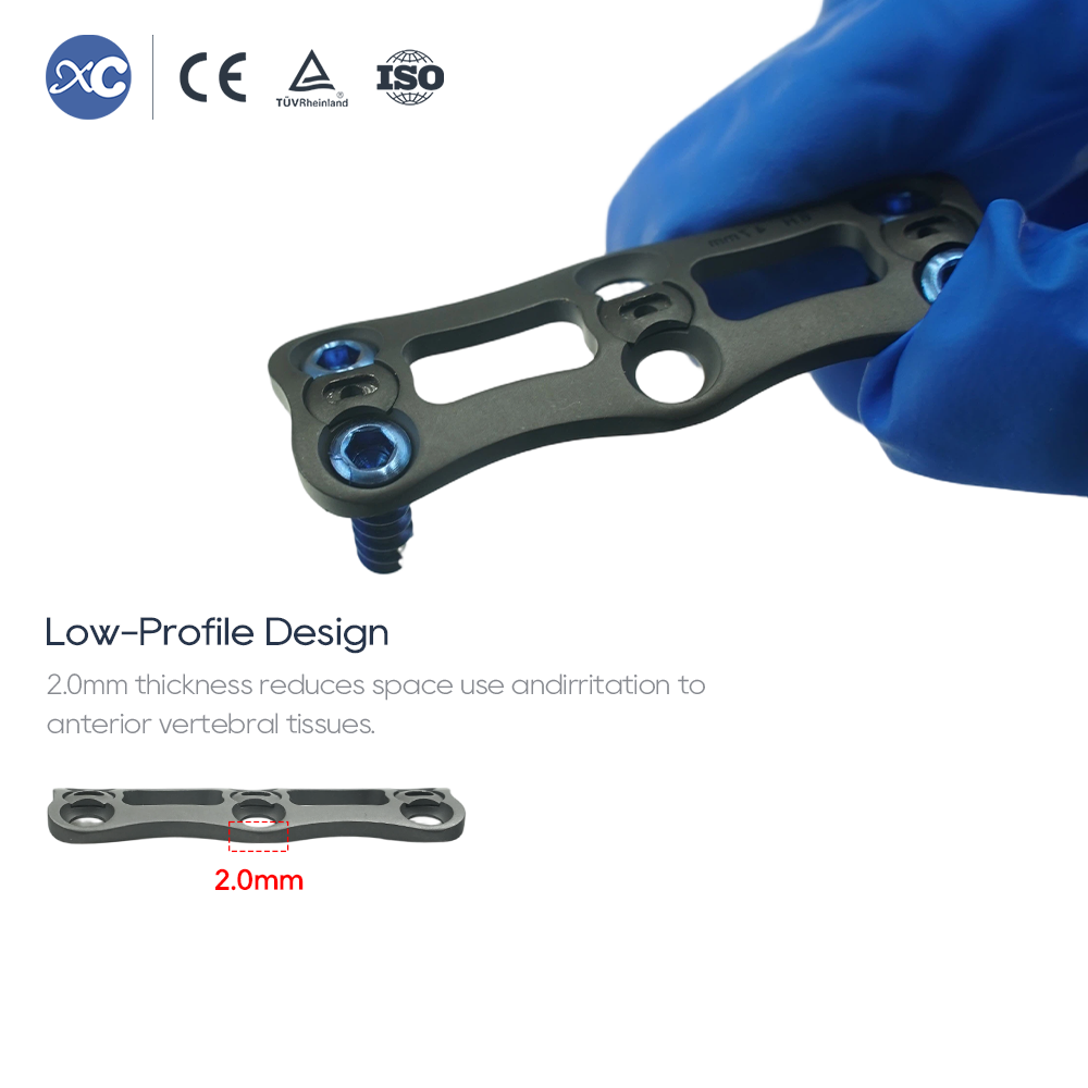 Sistem sprednjih cervikalnih plošč | Titanov hrbteniški vsadek | XC Medico