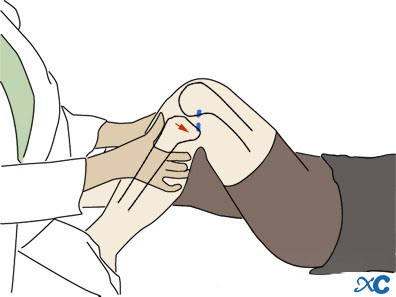 Articulaci&oacute; del genoll