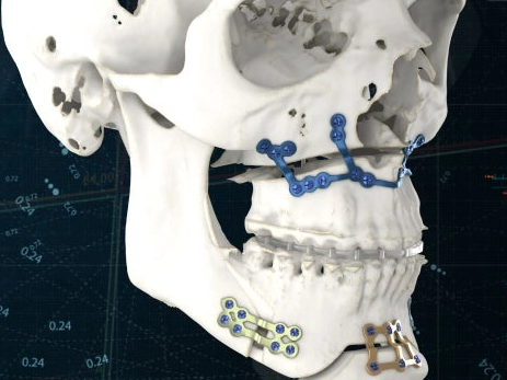 CROP_ 17397823264 30