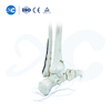 Plat Pengunci Tibiofibuler Distal-III - Beli Produk di XC Medico
