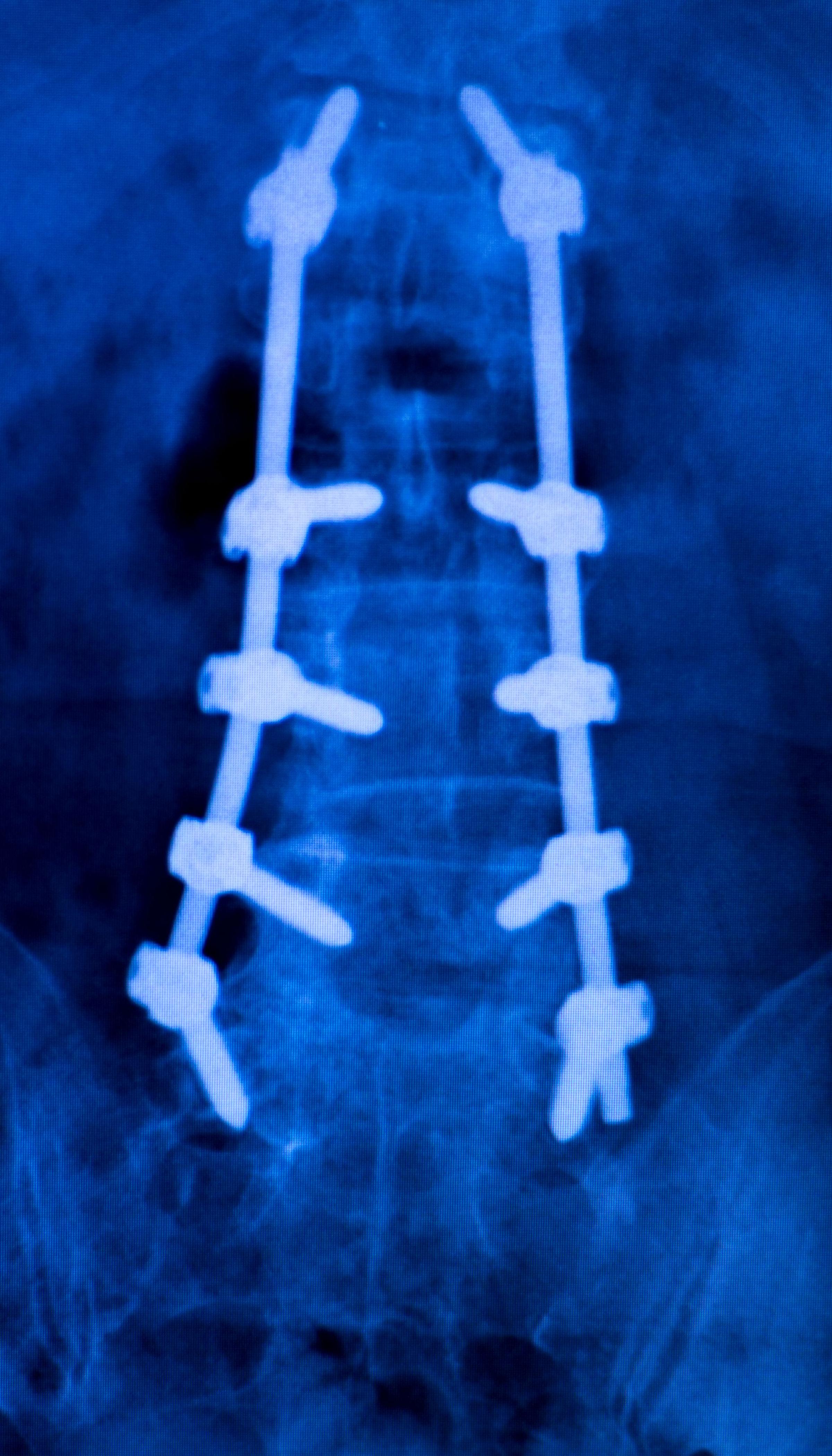 אילו אינדיקציות של עמוד השדרה מכסים המוצרים שלך?