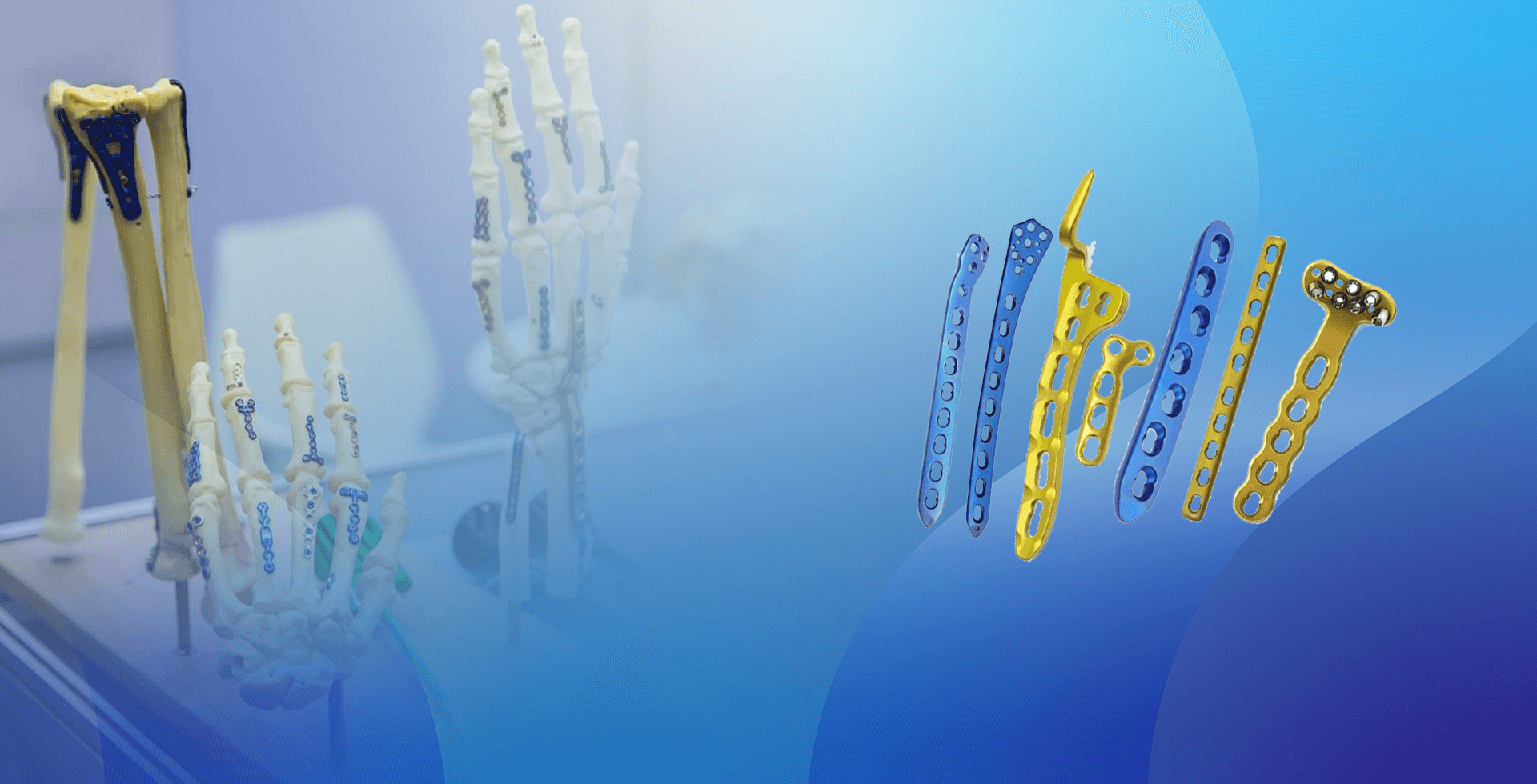 ບໍ່ມີ locking plate implant banner.png