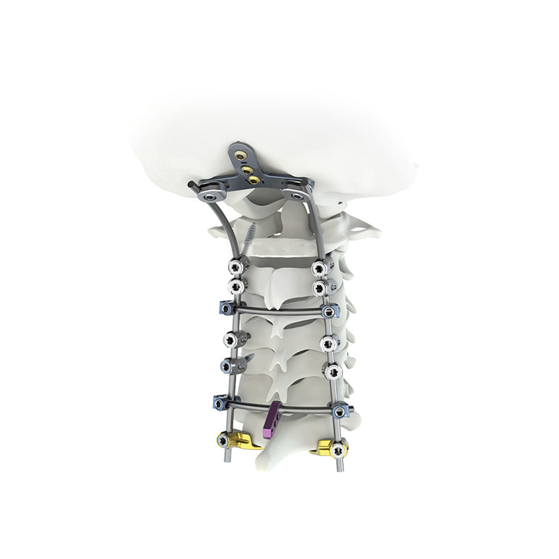 ഇൻ്റർബോഡി ഫ്യൂഷൻ കൂടുകൾ: നട്ടെല്ല് ചികിത്സയുടെ ഭാവി