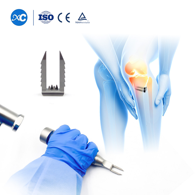 Ligament Nneɛma a Wɔde Yɛ Nhama | Soft Tissue Fixation a Wɔde Siesie ACL a Wɔsan Yɛ | XC Medico Agumadi Aduruyɛ