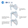 Placa de bloqueo de esc&aacute;pula para fijaci&oacute;n de fracturas de om&oacute;plato | XC M&eacute;dico -2