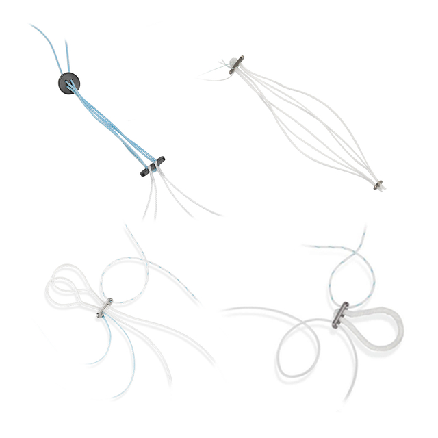 Ligamentfiksasiestelsel