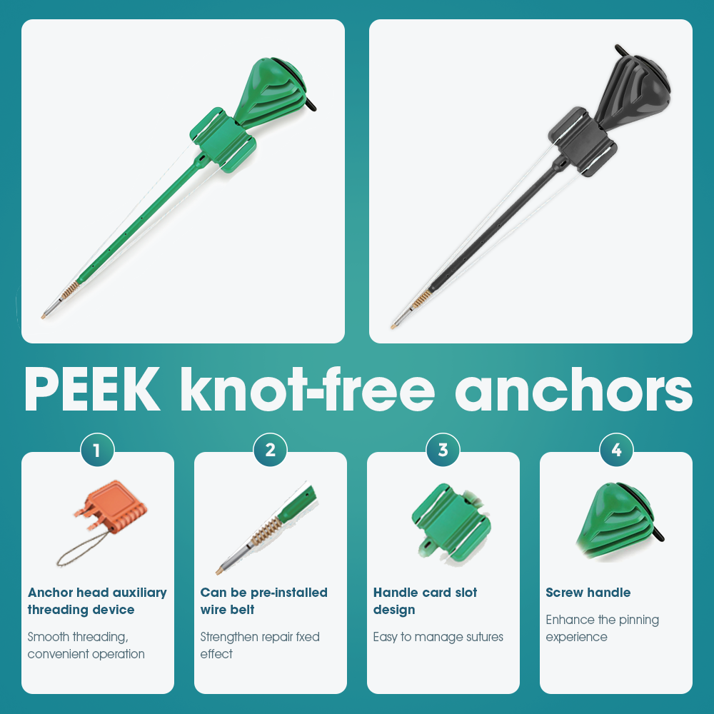 PEEK котви за шиење наспроти метални котви: што е подобро за поправка на манжетни?