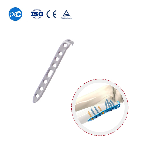 Ulnar Styloid Locking Plate