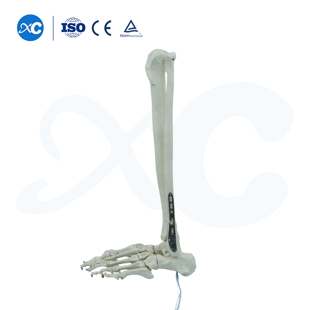 Plat Pengunci Tibiofibuler Distal-III - Beli Produk di XC Medico