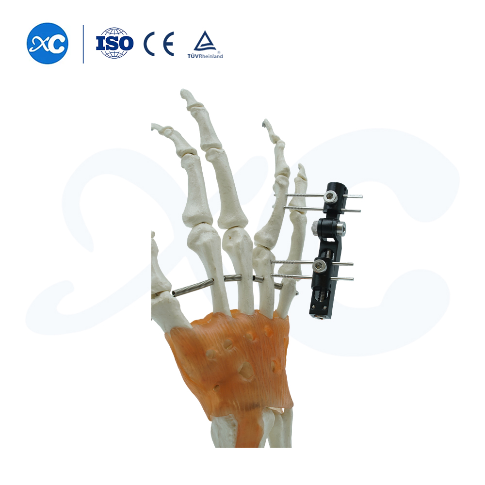 Mini Fixator Track Tu'aiga Tu'usa'o Tu'i