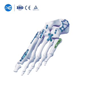 Hệ thống tấm kh&oacute;a b&agrave;n ch&acirc;n v&agrave; mắt c&aacute; ch&acirc;n