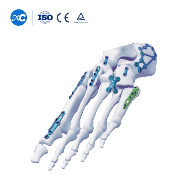 A&yacute;ak we topuk gulplama ulgamy