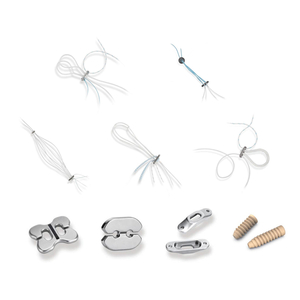 Mfumo wa Kurekebisha Ligament