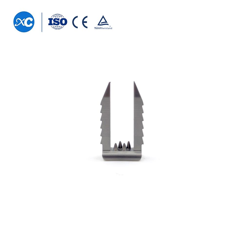 ലിഗമെൻ്റ് സ്റ്റേപ്പിൾ | ACL പുനർനിർമ്മാണത്തിനായുള്ള സോഫ്റ്റ് ടിഷ്യൂ ഫിക്സേഷൻ | XC മെഡിക്കോ സ്പോർട്സ് മെഡിസിൻ