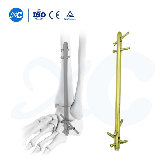 Clavo de tobillo para fusi&oacute;n del retropi&eacute; - Compre producto en XC Medico