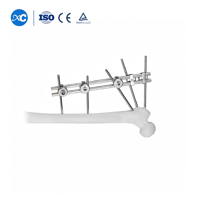 डबल रॉड्स ट्यूबरोसिटी संयोजन फिक्सेटर सी प्रकार