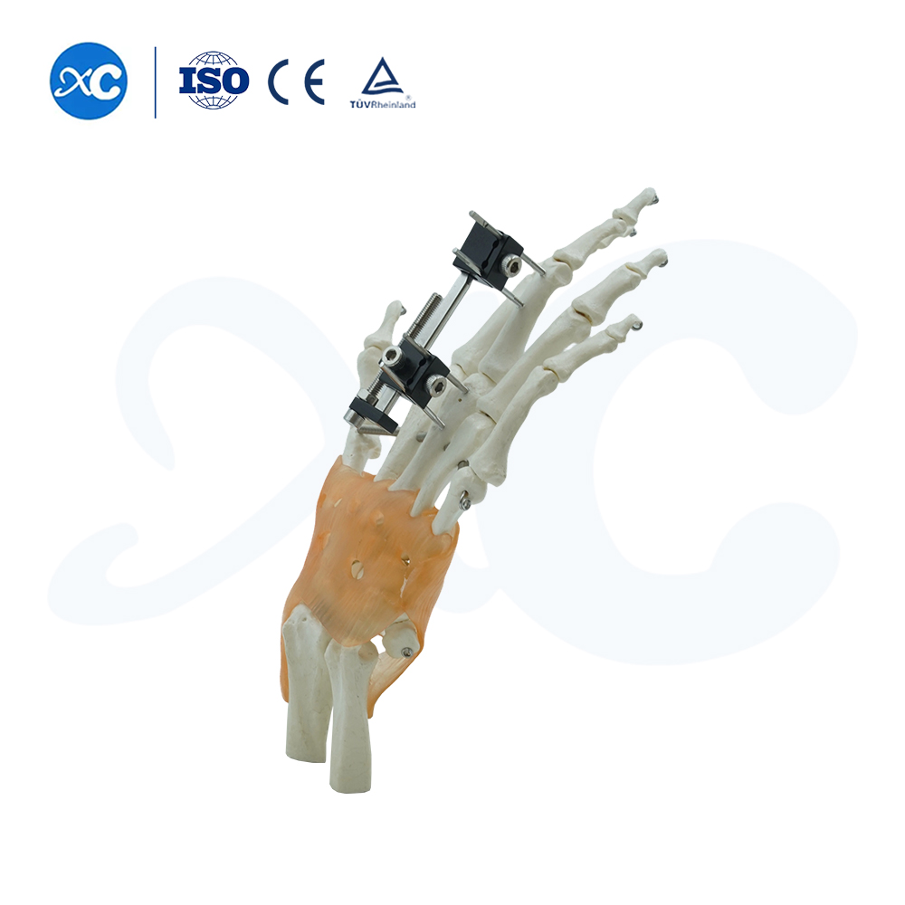 Mini Fixator Universal kompr&eacute;si Extension Tipe