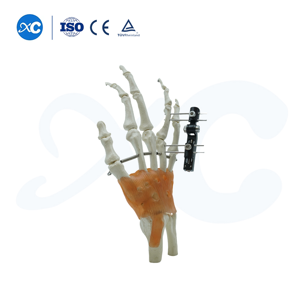 Mini Fixator Track Tu'aiga Tu'usa'o Tu'i