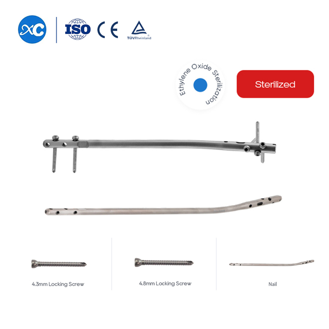 Tibia thar Intramedullary Nail | Orthopaedic Fixation chungchang | XC Medico chuan a rawn ti a