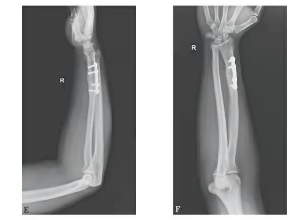 6.EF.png ዝብል ጽሑፍ ኣሎ።