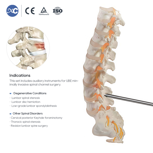 यूबीई रीढ़ की हड्डी सर्जरी उपकरण सेट - एक्ससी मेडिको