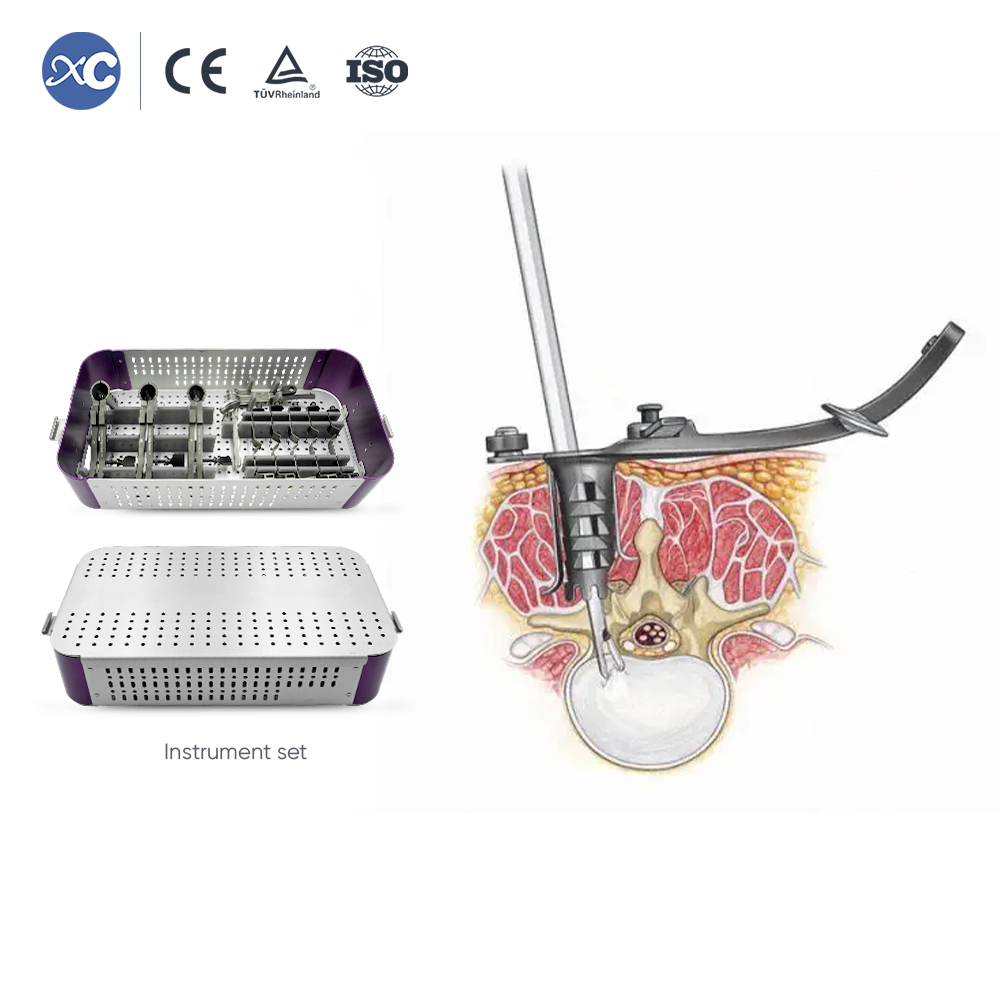 MLD Հոդակապ հետ քաշող հավաքածու | Micro Lumbar Discectomy գործիքներ