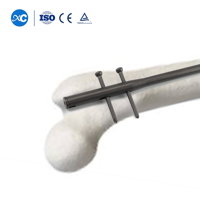 Femoral Intramedullary Nail | Femur Fixation | XC Medico