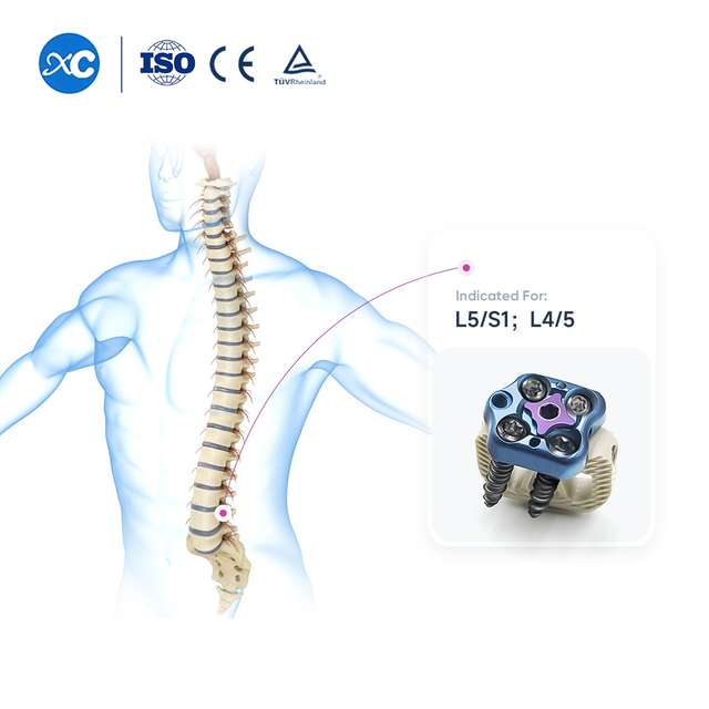 ALIF Cage & ATLPS Plate System - Anterior Lumbar Interbody Fusion Implant