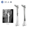 PFNA Intramedullary Nail | Proximal Femur Fracture Fixation