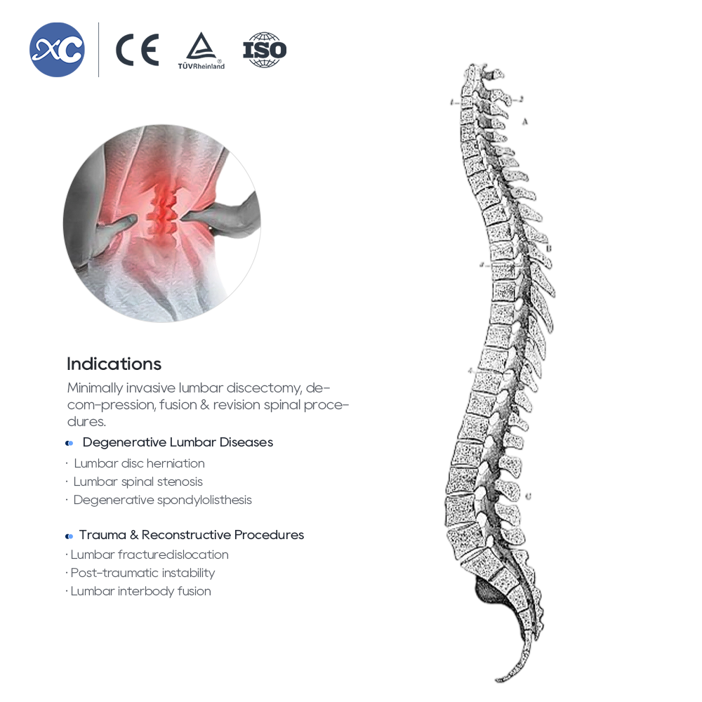MLD Հոդակապ հետ քաշող հավաքածու | Micro Lumbar Discectomy գործիքներ