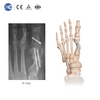 Qalabka Qalabka MIS Hallux Valgus Set | Tooska Warshada | XC Medico