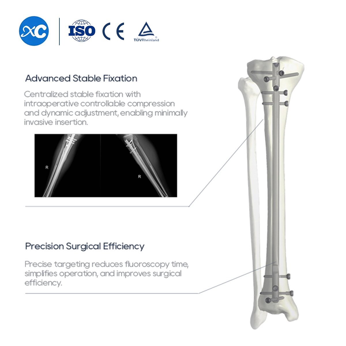 Yeye Tibial Intramedullary Nail Dɔwɔnu Set | XC Medico ƒe dɔwɔƒe