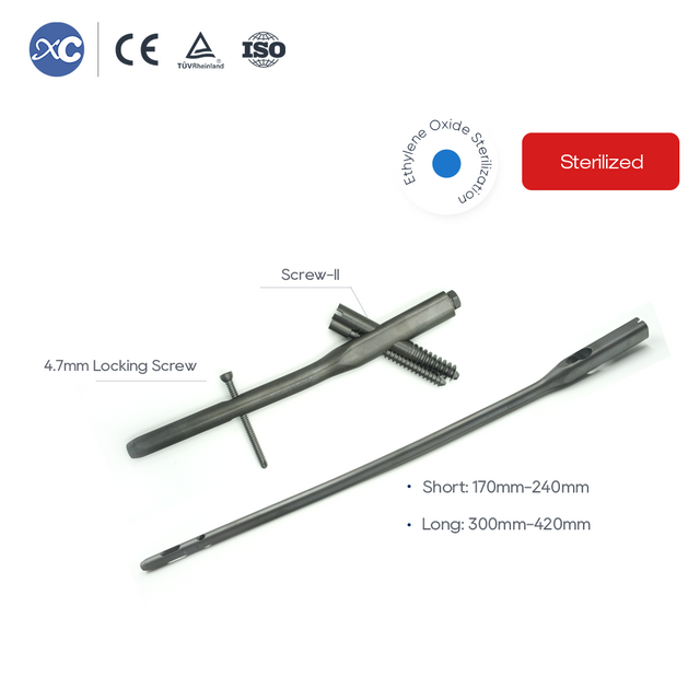 इंटरटन नेल सिस्टम | xc मेडिको