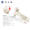Qalabka Qalabka MIS Hallux Valgus Set | Tooska Warshada | XC Medico