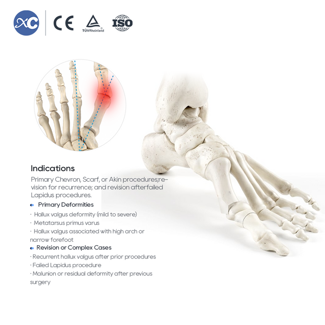 Sada n&aacute;strojov MIS Hallux Valgus | Factory Direct | XC Medico