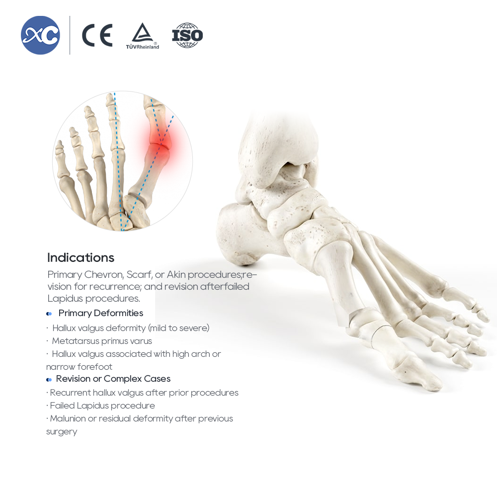 Qalabka Qalabka MIS Hallux Valgus Set | Tooska Warshada | XC Medico